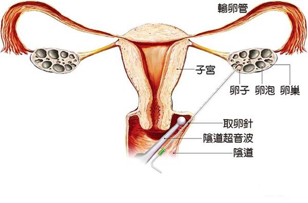 浅谈河北代怀男孩费用多少最好的医院+附医院选择解析